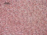 5 - Cellule corticali in visione superficiale